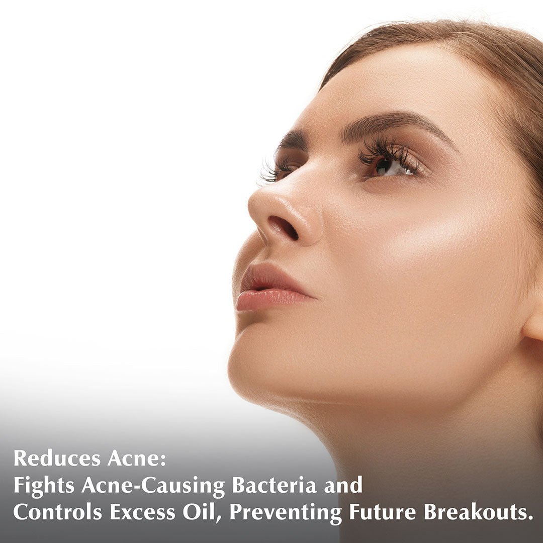 Anti-Acne Encapsulated Face Cream (50gm)